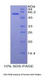 Human Adenosine Deaminase (ADA) Protein