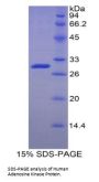 Human Adenosine Kinase (ADK) Protein