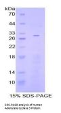 Human Adenylate Cyclase 3 (ADCY3) Protein