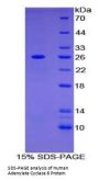 Human Adenylate Cyclase 6 (ADCY6) Protein