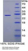 Mouse Adenylate Cyclase 6 (ADCY6) Protein