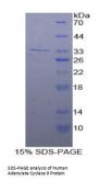 Human Adenylate Cyclase 9 (ADCY9) Protein