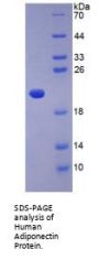 Human Adiponectin (ADIPOQ) Protein