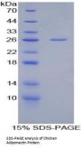 Chicken Adiponectin (ADIPOQ) Protein