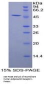 Human Adiponectin Receptor 1 (ADIPOR1) Protein