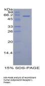 Human Adiponectin Receptor 1 (ADIPOR1) Protein