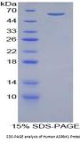 Human Adrenergic Receptor Beta Kinase 1 (ADRbK1) Protein