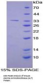 Mouse Alanine Aminotransferase 1 (GPT) Protein