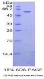 Human Alpha-2-Heremans Schmid Glycoprotein (AHSG) Protein