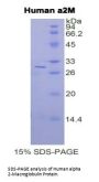 Human Alpha-2-Macroglobulin (A2M) Protein