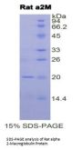Rat Alpha-2-Macroglobulin (A2M) Protein