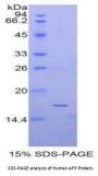 Human Alpha Fetoprotein (AFP) Protein