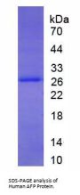 Human Alpha Fetoprotein (AFP) Protein
