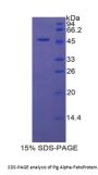 Pig Alpha Fetoprotein (AFP) Protein
