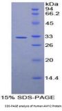 Human Amylase Alpha 2, Pancreatic (AMY2) Protein