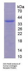Human Androgen Receptor (AR) Protein