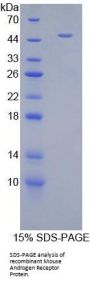 Mouse Androgen Receptor (AR) Protein
