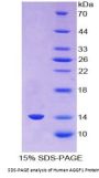 Human Angiogenic Factor With G Patch And FHA Domains 1 (AGGF1) Protein