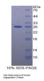 Human Angiopoietin 1 (ANGPT1) Protein