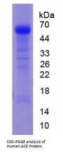 Human Angiotensin I Converting Enzyme (ACE) Protein