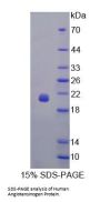 Human Angiotensinogen (AGT) Protein
