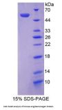 Mouse Angiotensinogen (AGT) Protein