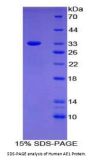 Human Anion Exchange Protein 1 (AE1) Protein