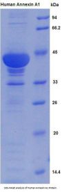 Human Annexin A1 (ANXA1) Protein