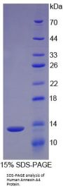 Human Annexin A4 (ANXA4) Protein