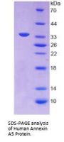 Human Annexin A5 (ANXA5) Protein