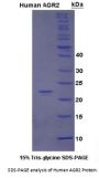 Human Anterior Gradient Protein 2 (AGR2) Protein