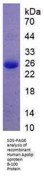 Human Apolipoprotein B-100 (APOB) Protein
