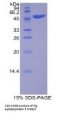 Pig Apolipoprotein B (APOB) Protein