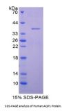 Human Aquaporin 1, Colton Blood Group (AQP1) Protein