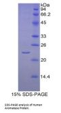 Human Aromatase (CYP19A1) Protein