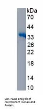 Human Aryl Hydrocarbon Receptor (AhR) Protein