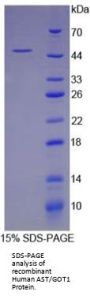 Human Aspartate Aminotransferase, Cytoplasmic (GOT1) Protein