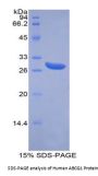 Human ATP Binding Cassette Subfamily G Member 1 (ABCG1) Protein