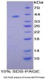 Human B-Cell Activation Factor Receptor / BAFFR (TNFRSF13C) Protein