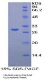Rat B-Cell CLL/Lymphoma 3 (Bcl3) Protein