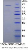 Mouse Beta-Site APP Cleaving Enzyme 2 (bACE2) Protein