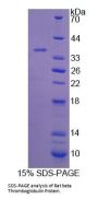 Rat Beta-Thromboglobulin (bTG) Protein