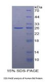 Human BH3 Interacting Domain Death Agonist (Bid) Protein