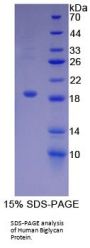 Human Biglycan (BGN) Protein