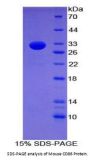 Mouse T-Lymphocyte Activation Antigen CD86 (CD86) Protein
