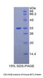 Mouse Cyclic ADP-Ribose Hydrolase 2 (BST1) Protein