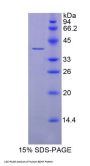 Human Brain Derived Neurotrophic Factor (BDNF) Protein