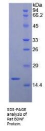 Rat Brain Derived Neurotrophic Factor (BDNF) Protein