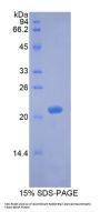 Rabbit Brain Derived Neurotrophic Factor (BDNF) Protein