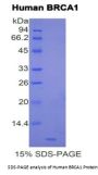 Human Breast Cancer Susceptibility Protein 1 (BRCA1) Protein